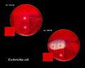 escherichia coli